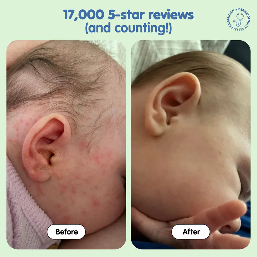 TUBBY TODD All Over Ointment Baby Eczema Cream